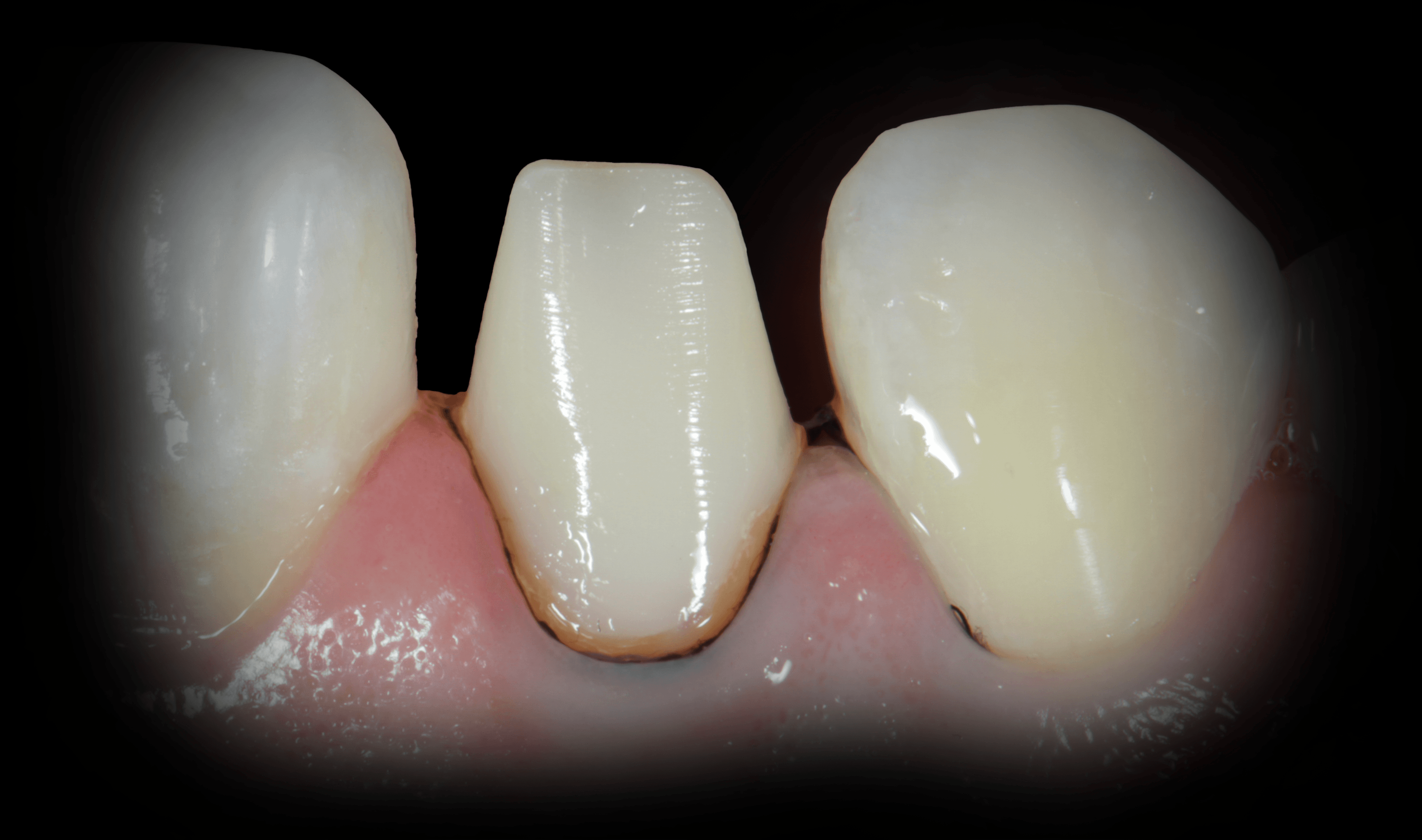 Técnica Restauradora